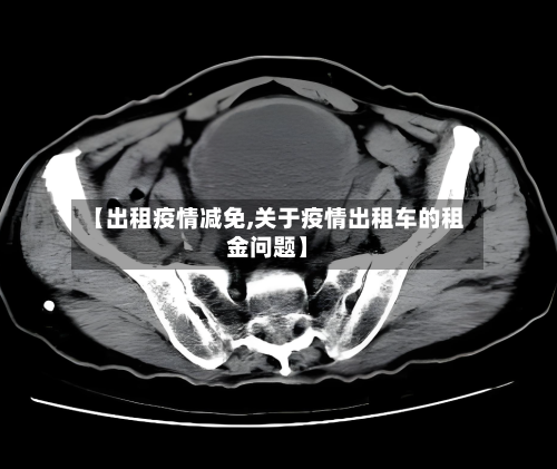 【出租疫情减免,关于疫情出租车的租金问题】-第2张图片