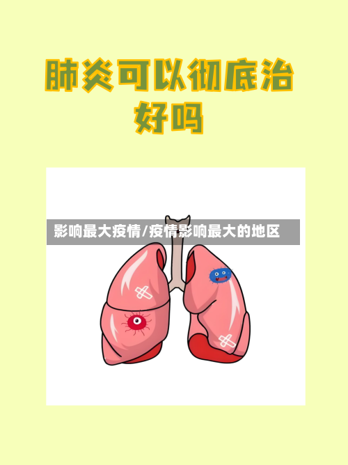 影响最大疫情/疫情影响最大的地区