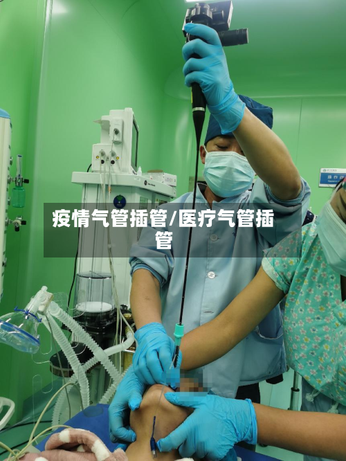 疫情气管插管/医疗气管插管