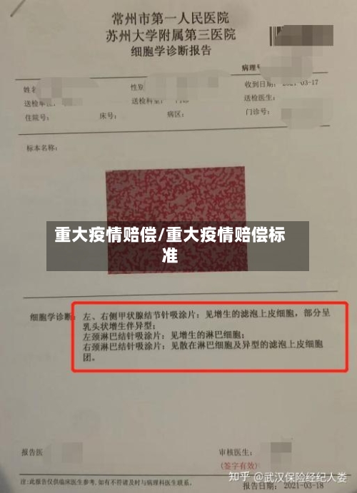 重大疫情赔偿/重大疫情赔偿标准-第3张图片