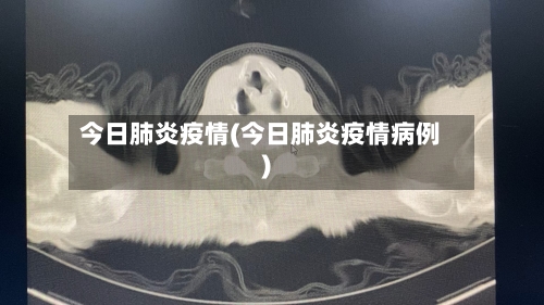 今日肺炎疫情(今日肺炎疫情病例)