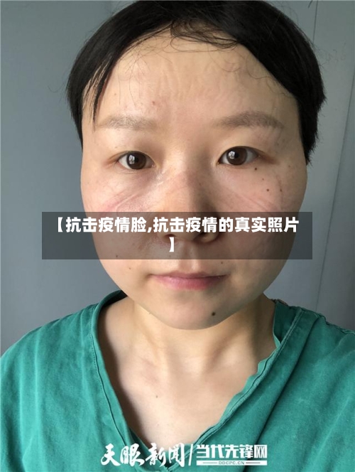 【抗击疫情脸,抗击疫情的真实照片】