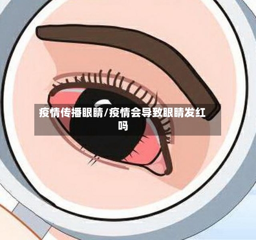 疫情传播眼睛/疫情会导致眼睛发红吗